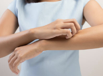 Mis on atoopiline dermatiit?